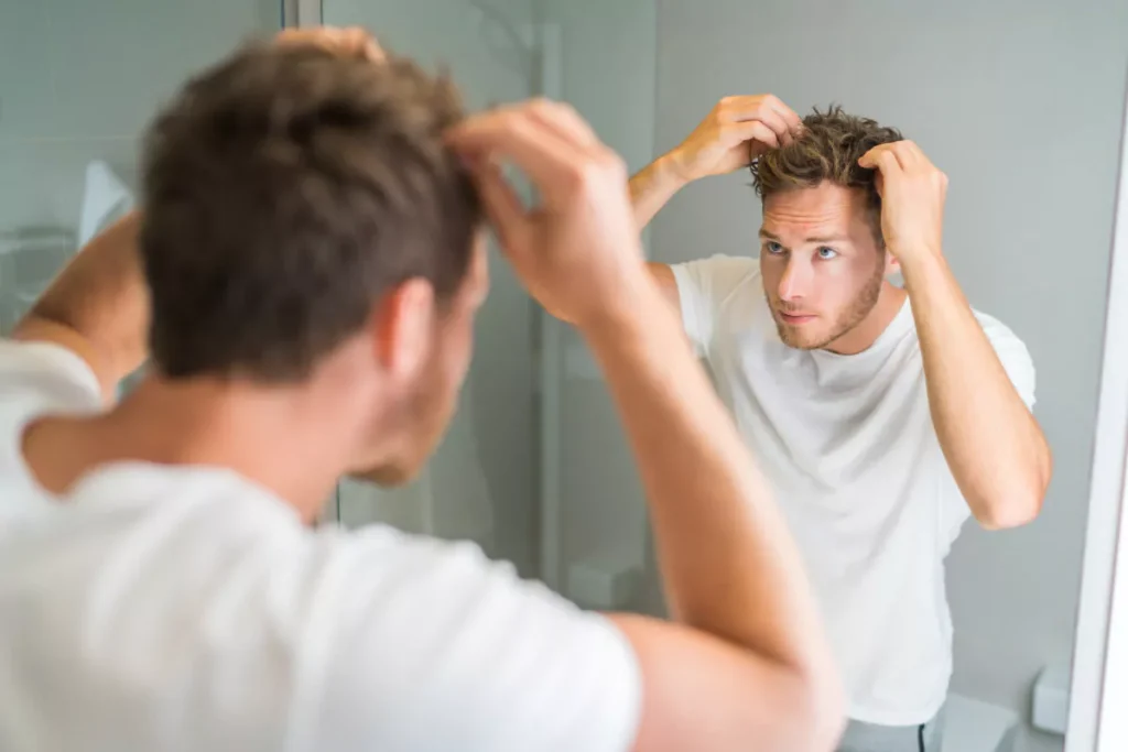 مشکل ریزش موی مردانه