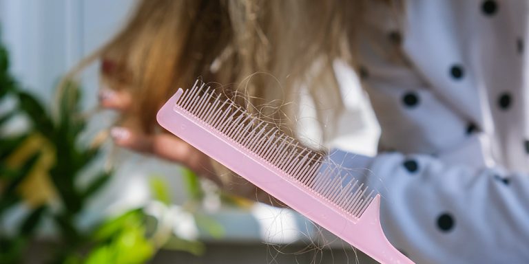 ریزش موی فصلی چیست؟